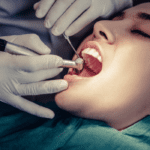 Root canal treatment in Kochi